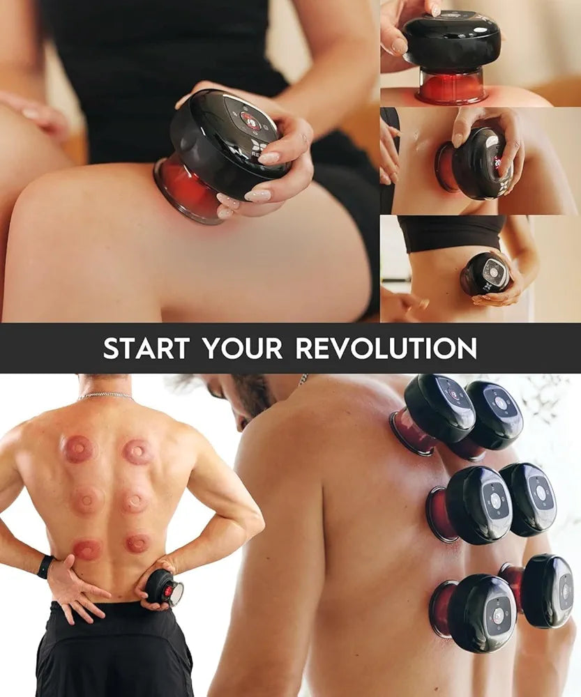 Electric Cupping Therapy Machine with 12-Level Suction & Heating Function
